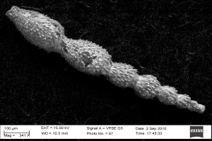 Ein Schwarzweiß-Scanbild einer Mikroorganismus-Zelle mit beschreibendem Text unten.